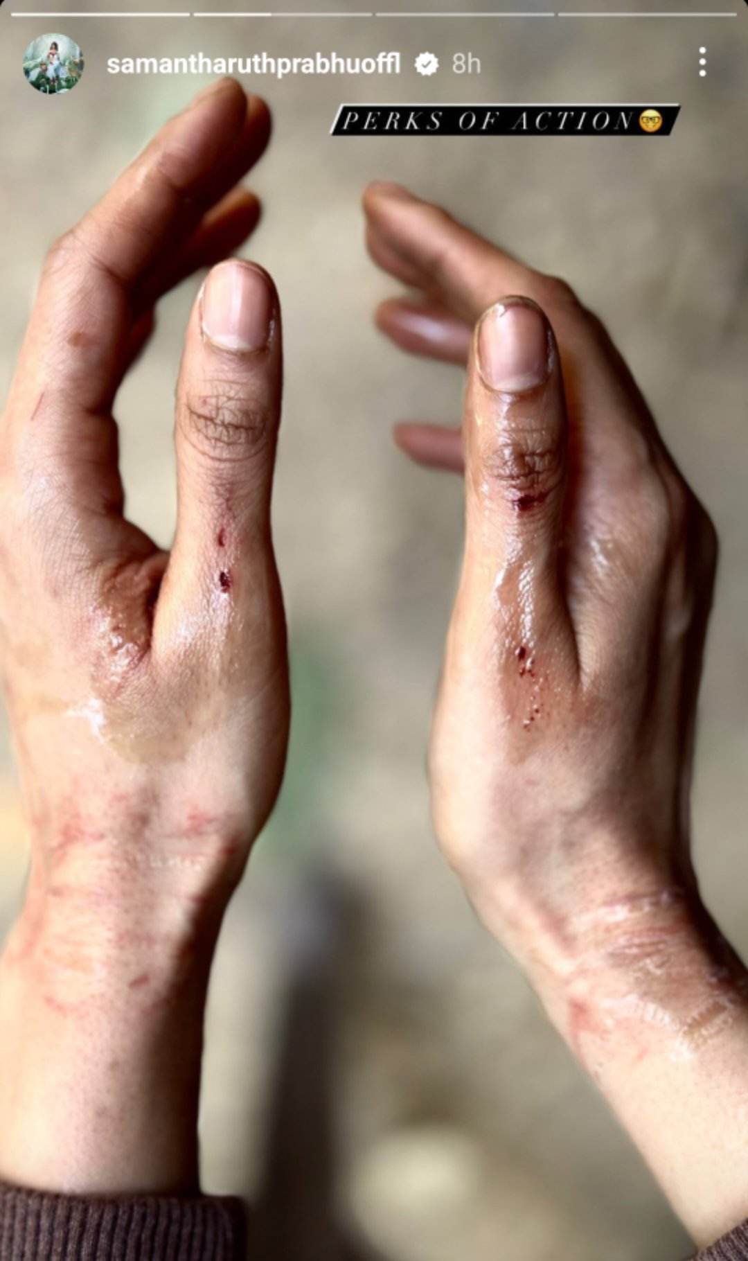 মারাত্মক দুর্ঘটনার শিকার সামান্থা রুথ প্রভু