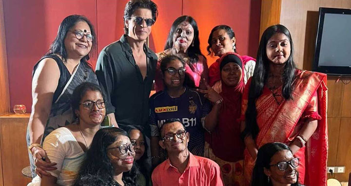 অ্যাসিড দগ্ধদের পাশে থাকার অঙ্গীকার শাহরুখ খানের