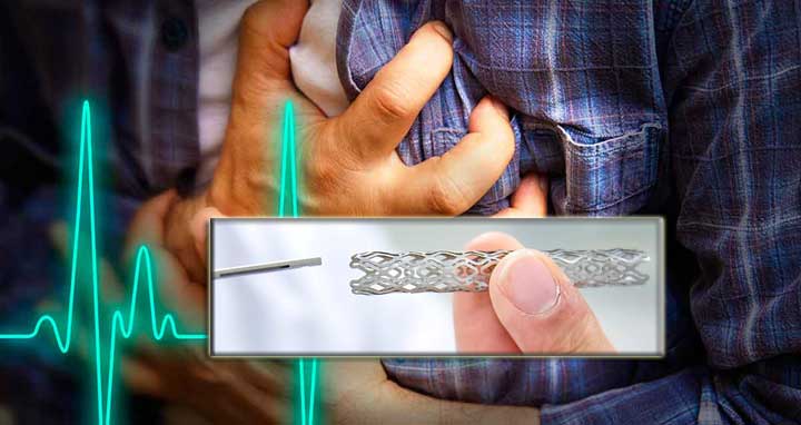 সিদ্ধান্ত ছাড়াই বৈঠক শেষ, হার্টের রিং নিয়ে সংকট থাকছেই