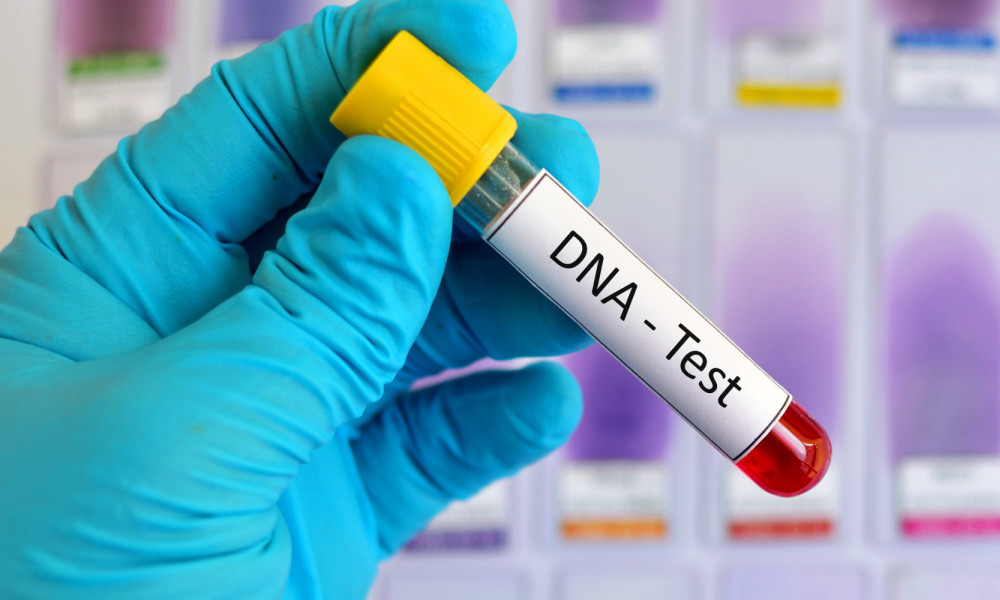 ডিএনএ টেস্টে নিহত ৫ জনের পরিচয় শনাক্ত