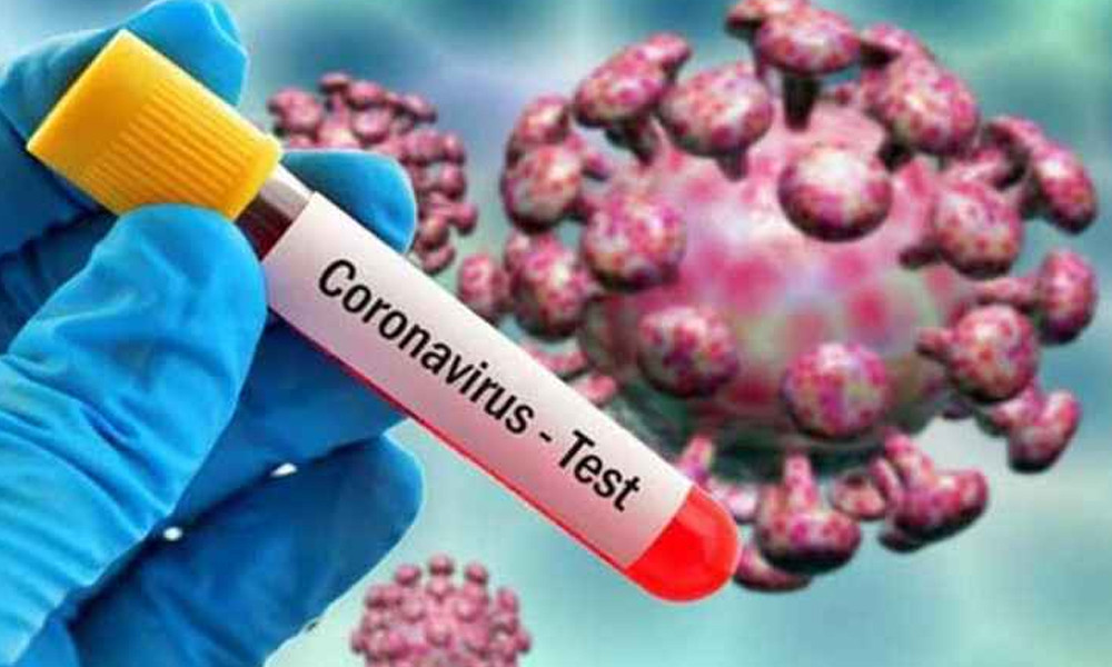করোনায় আরো একজনের মৃত্যু, শনাক্ত ৩