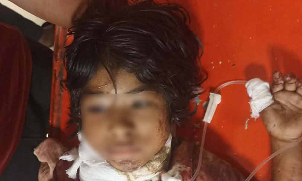 সীতাকুণ্ডের ইকোপার্কে গলা কাটা সেই শিশুটি মারা গেছে