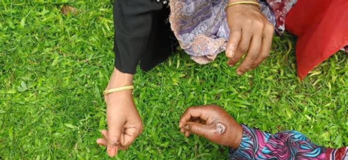 রংপুর অঞ্চলে অ্যানথ্রাক্সের হটস্পট গাইবান্ধার সুন্দরগঞ্জ